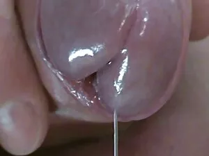آیا کندیس جرات گسترش ...